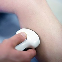 Ein Venenultraschall oder Venenfunktionstest wird am Arm eines Patienten durchgeführt.